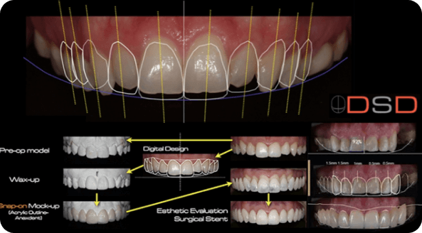 Mona Vale Dental, your trusted dental care provider